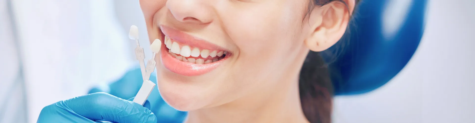 Mano enguantada sosteniendo una herramienta para comparar el color de los dientes frente a la sonrisa de una mujer.