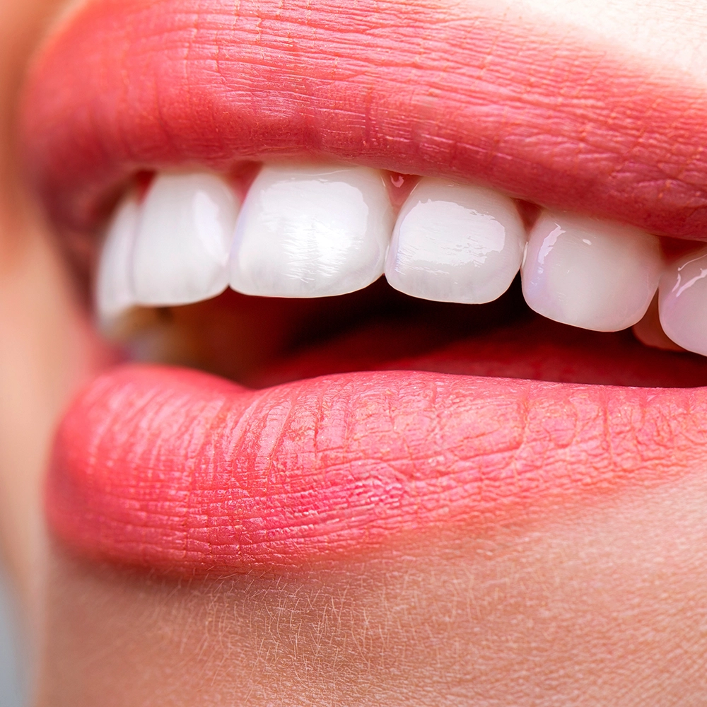 Primer plano de la sonrisa de una mujer mostrando sus dientes.