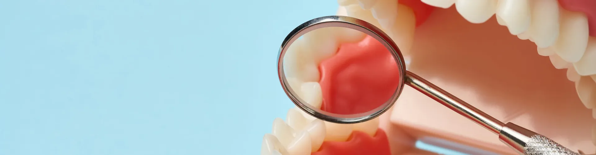Espejo dental mostrando encías y dientes sanos durante un examen oral.