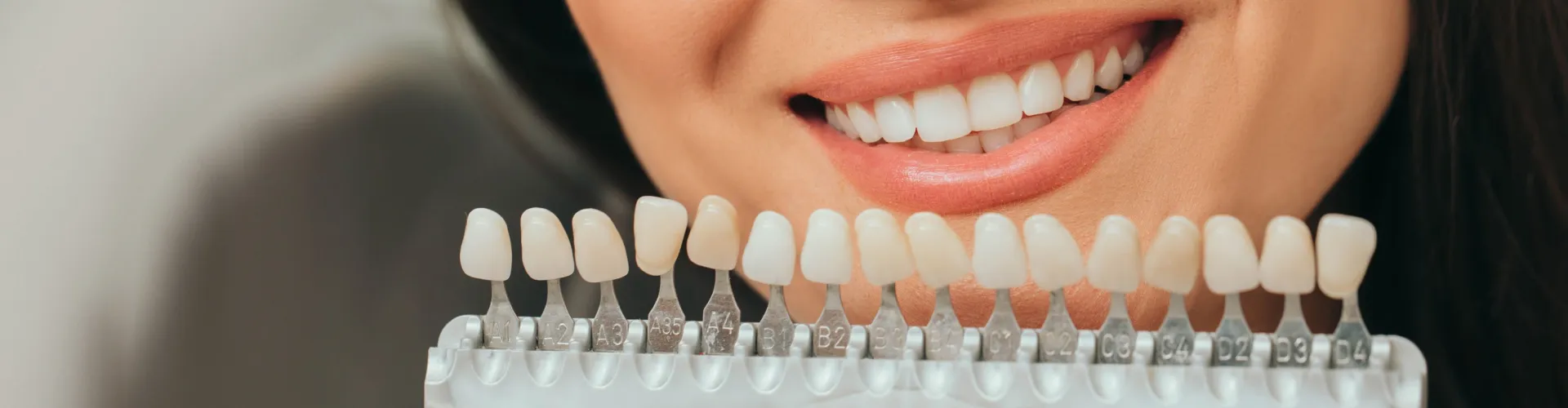 Herramienta de selección de tono dental frente a la sonrisa de una mujer.