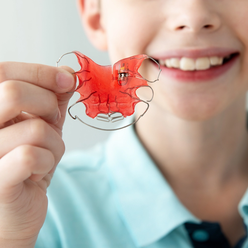 Primer plano de un niño sosteniendo un expansor palatino, sonriendo, con su rostro desenfocado en el fondo.