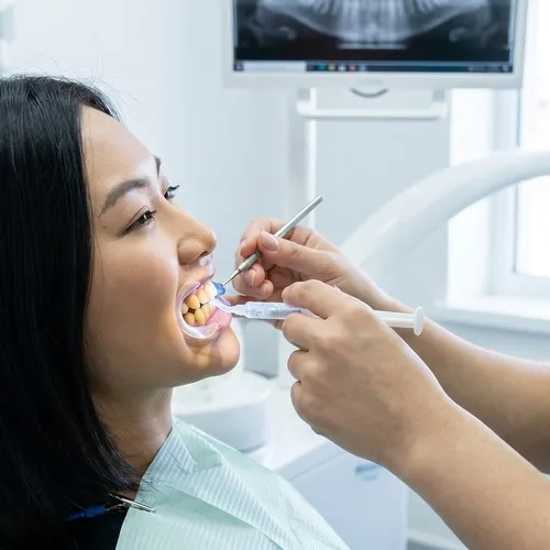 Dentista aplicando gel blanqueador en los dientes de un paciente.