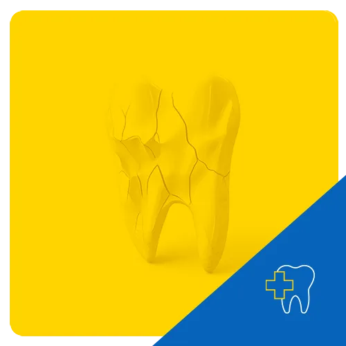 Ilustración 3D de un molar agrietado sobre un fondo amarillo, simbolizando el trauma dental.