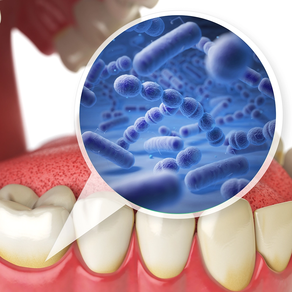 Representación 3D de dientes con un globo de diálogo que muestra una ilustración 3D de bacterias saliendo de un diente.