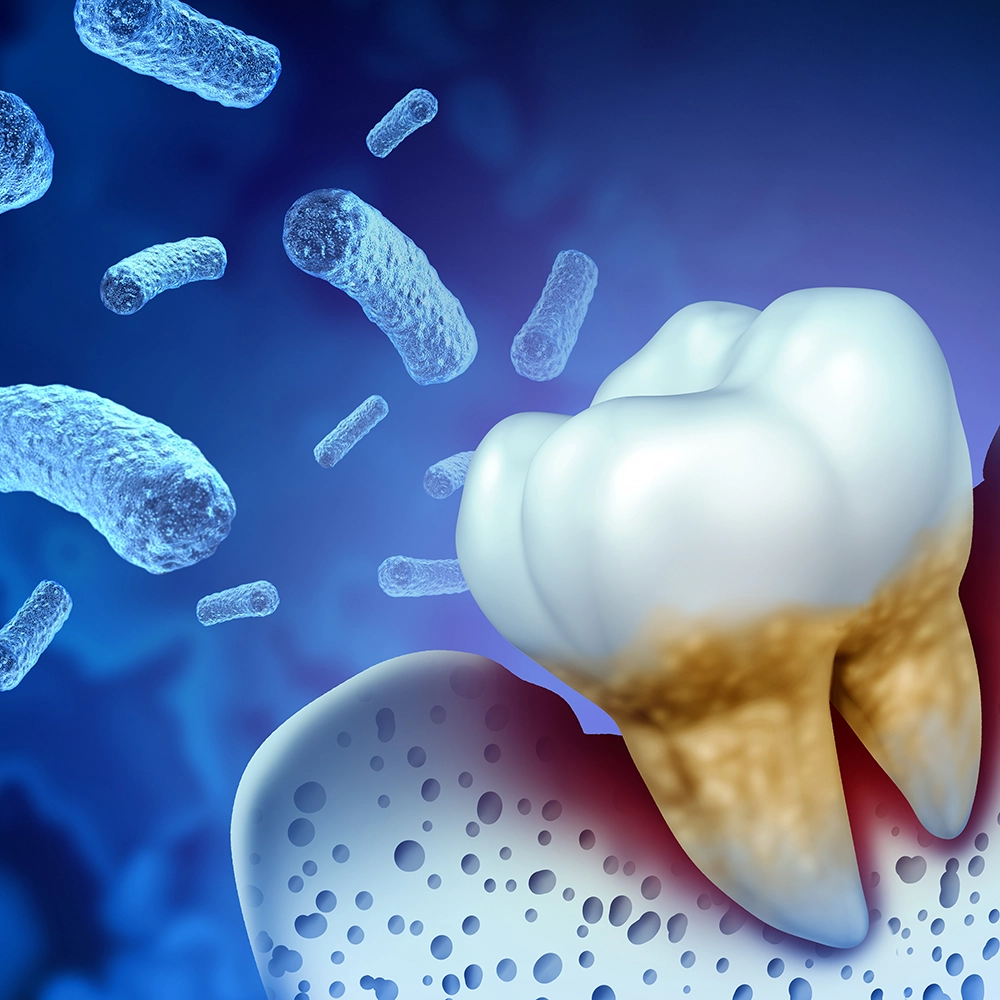 Representación 3D de un diente rodeado de bacterias sobre un fondo azul.