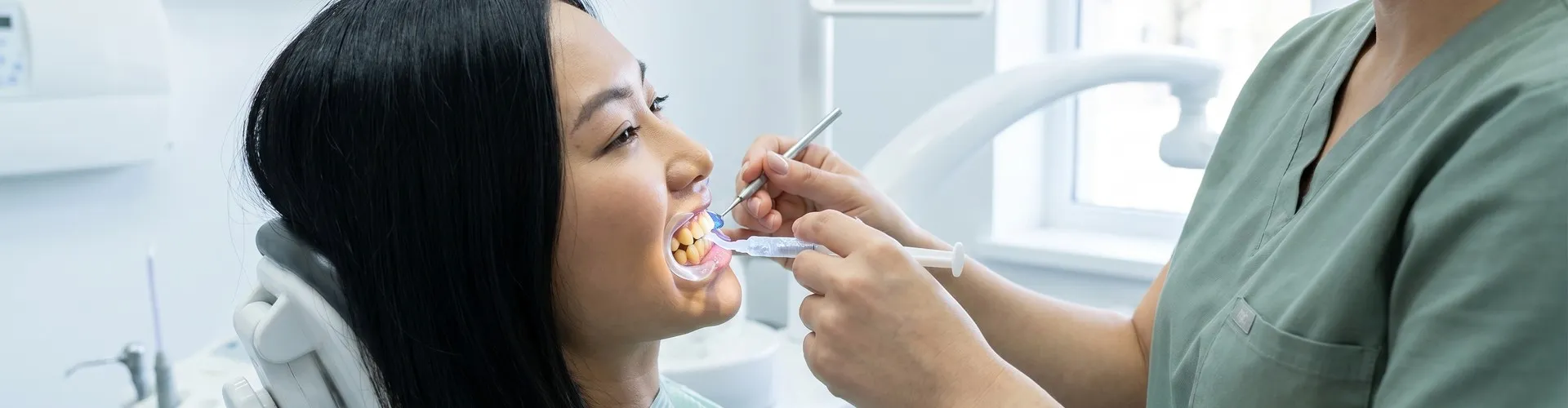Dentista aplicando gel blanqueador en los dientes de un paciente.