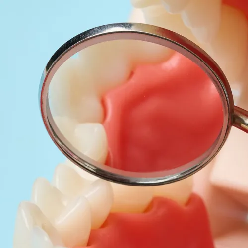 Espejo dental mostrando encías y dientes sanos durante un examen oral.