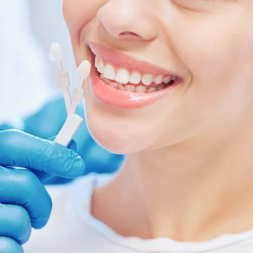 Mano enguantada sosteniendo una herramienta para comparar el color de los dientes frente a la sonrisa de una mujer.