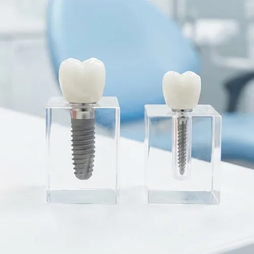 Implante dental junto a mini implante dental sobre superficie blanca.