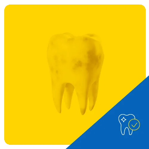 Gráfico 3D de un diente molar con manchas visibles sobre un fondo amarillo vibrante, destacando la decoloración dental.