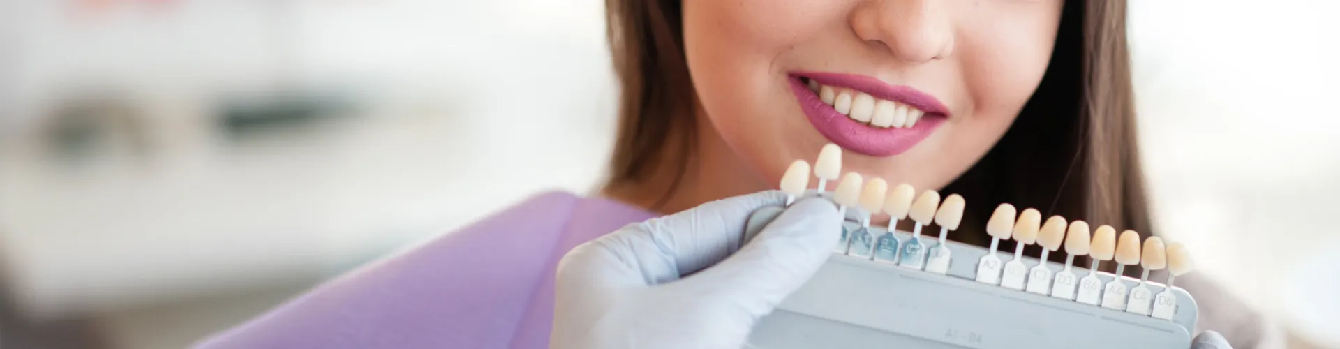 Dentista sosteniendo una guía de tonos para combinar carillas dentales para un cambio de sonrisa del paciente.