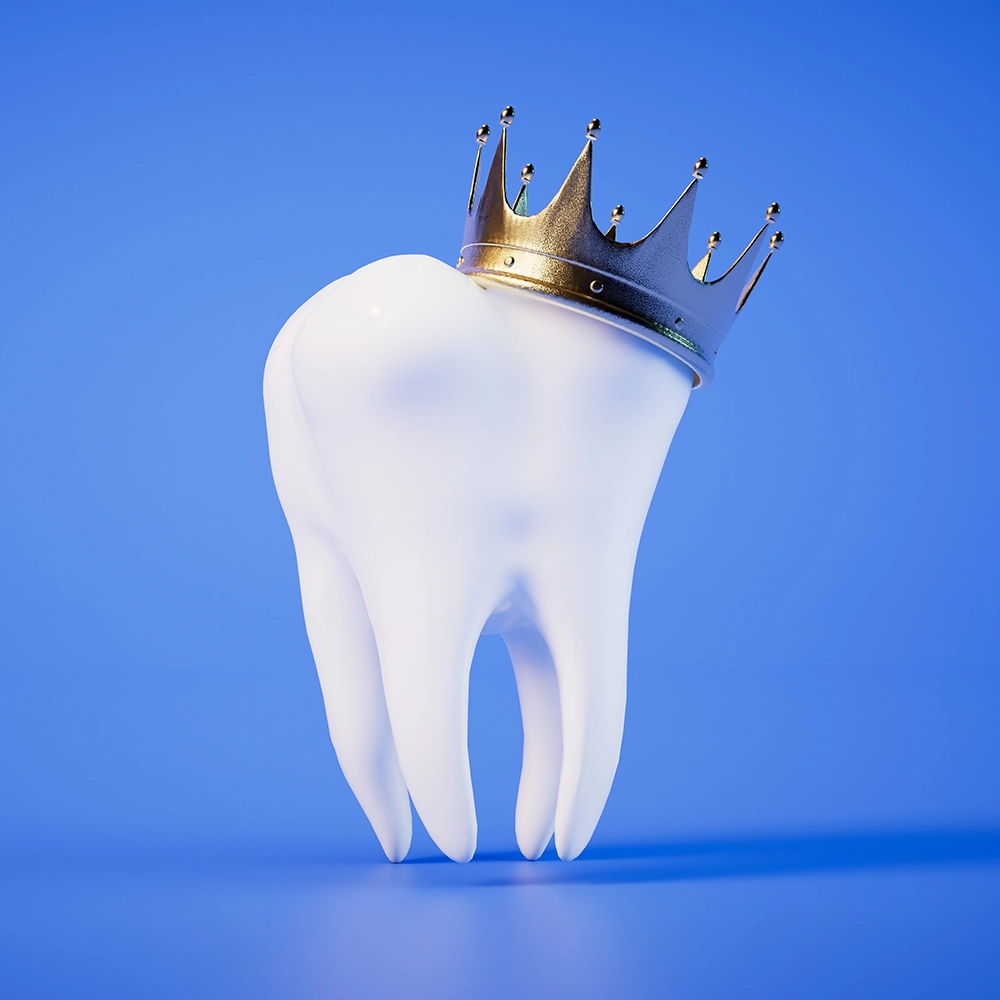 Representación 3D de un diente con una corona de oro encima.