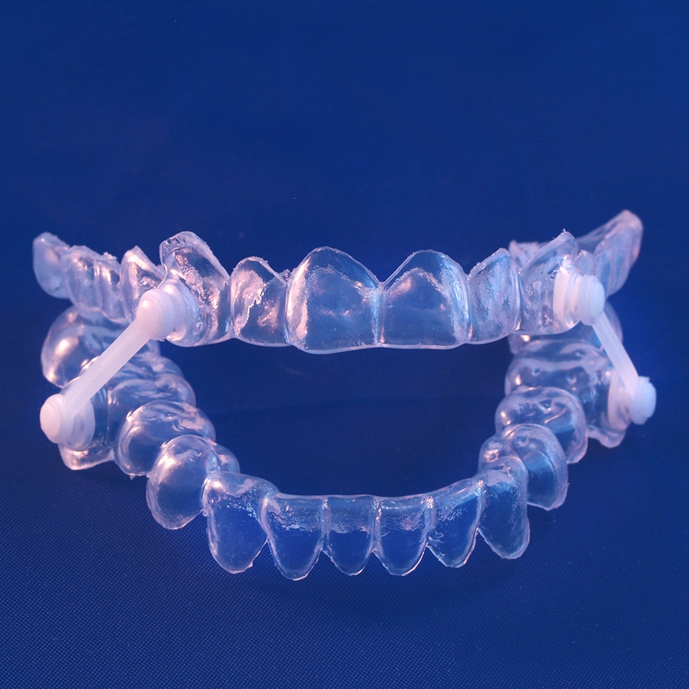 Dispositivo para apnea del sueño con forma de Invisalign que mantiene cerradas la mandíbula superior e inferior, sobre fondo azul.
