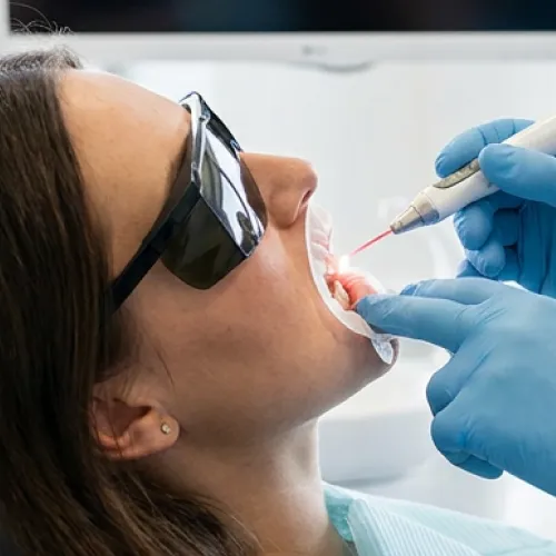 Paciente sometiéndose un tratamiento de contorneado de encías con láser mientras usa gafas protectoras, mientras el dentista remodela cuidadosamente la línea de las encías para mejorar la estética de la sonrisa y la salud bucal.