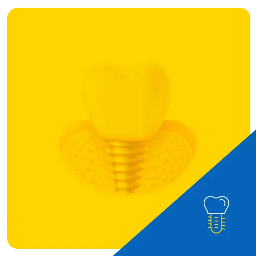 Gráfico 3D de un implante dental con un diente montado sobre un poste tipo tornillo, colocado sobre una base con patrón de panal amarillo, simbolizando el proceso de implante dental.