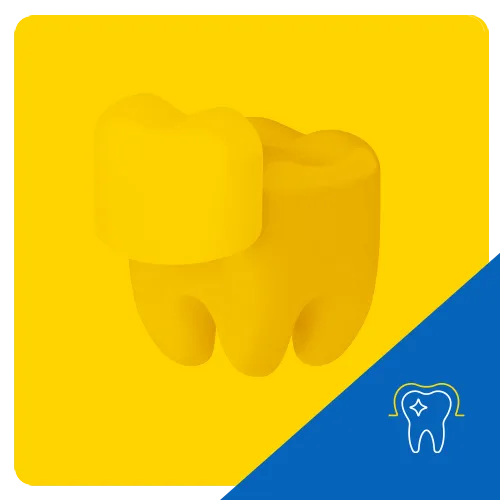 Gráfico 3D de un diente cubierto por una carilla, sobre un fondo amarillo, representando el tratamiento dental cosmético con carillas.